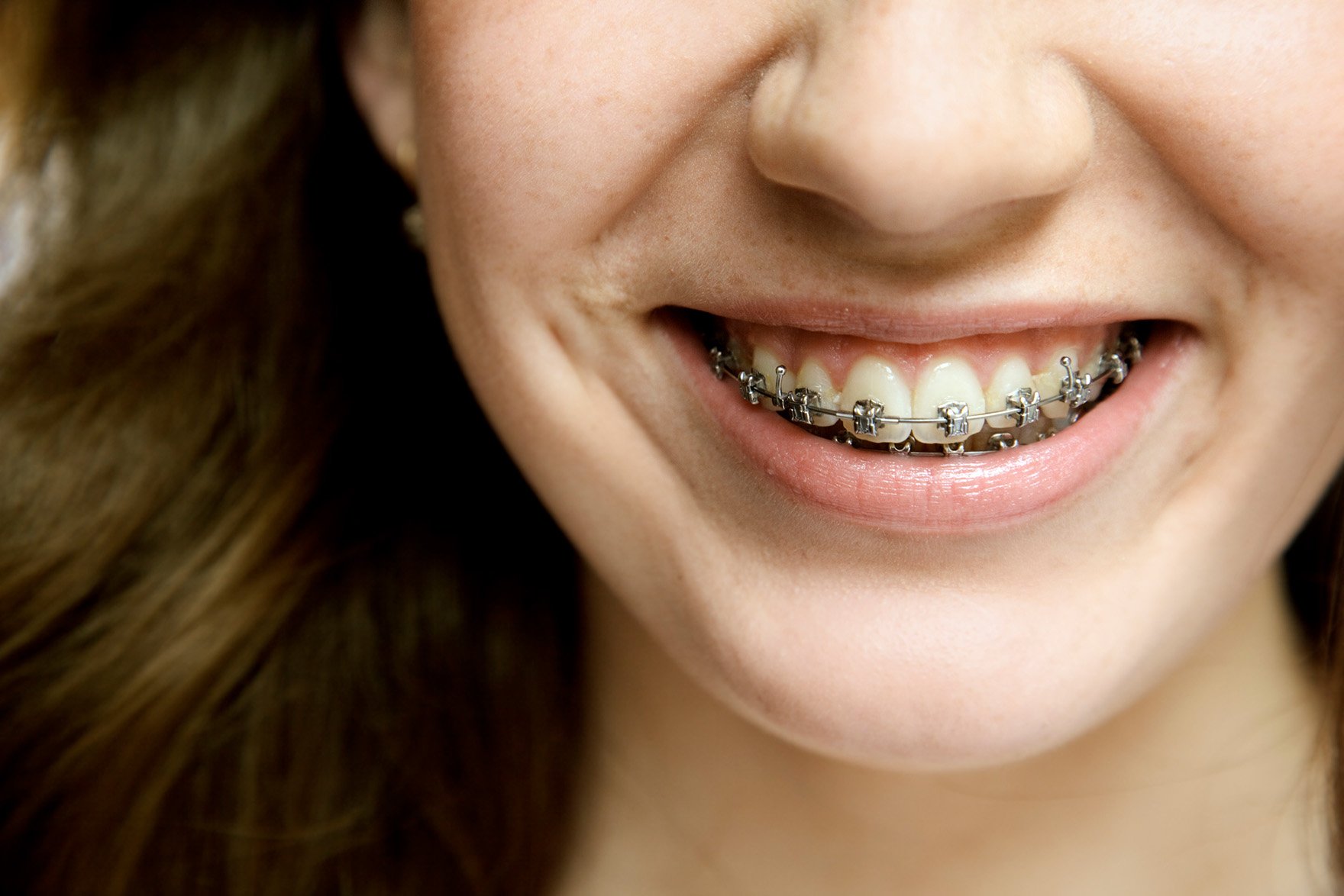 Orthodontist in Buffalo Grove and Highland Park, IL Rosen Orthodontics