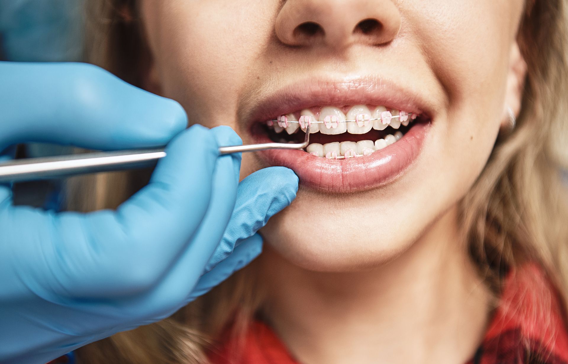 Close-up of a smiling patient with pink braces during an exam.