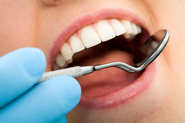 Using mirror spoon on teeth — Buffalo Grove, IL — Rosen Orthodontics Using mirror spoon on teeth — Buffalo Grove, IL — Rosen Orthodontics