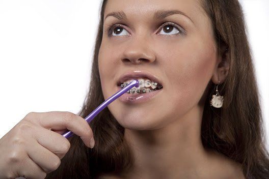Woman using interdental toothbrush — Buffalo Grove, IL — Rosen Orthodontics Woman using interdental toothbrush — Buffalo Grove, IL — Rosen Orthodontics