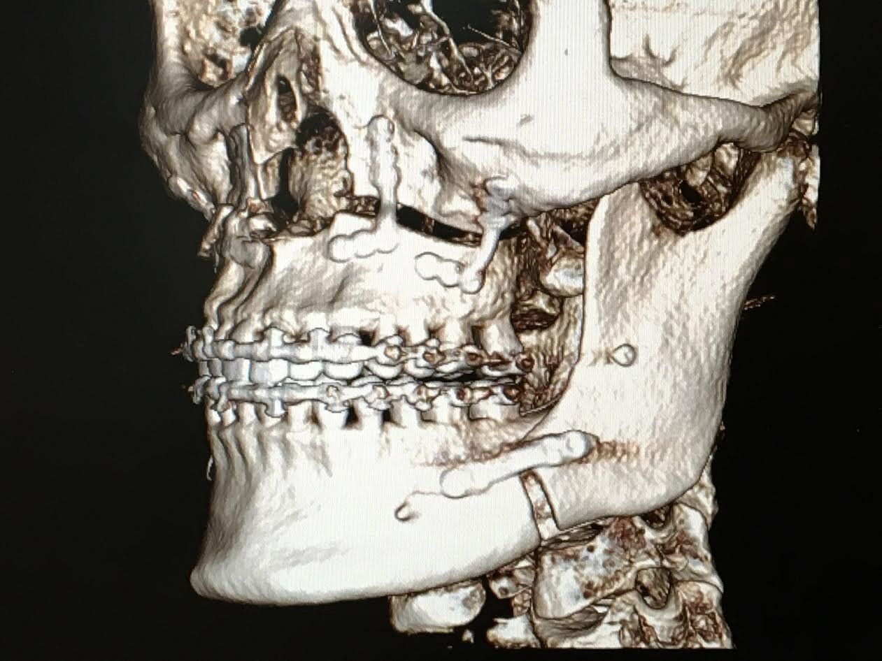 X-ray result — Buffalo Grove, IL — Rosen Orthodontics X-ray result — Buffalo Grove, IL — Rosen Orthodontics