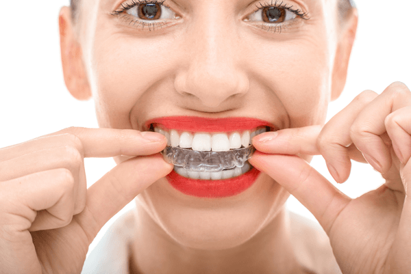 Woman showing her invisalign retainer — Buffalo Grove, IL — Rosen Orthodontics Woman showing her invisalign retainer — Buffalo Grove, IL — Rosen Orthodontics