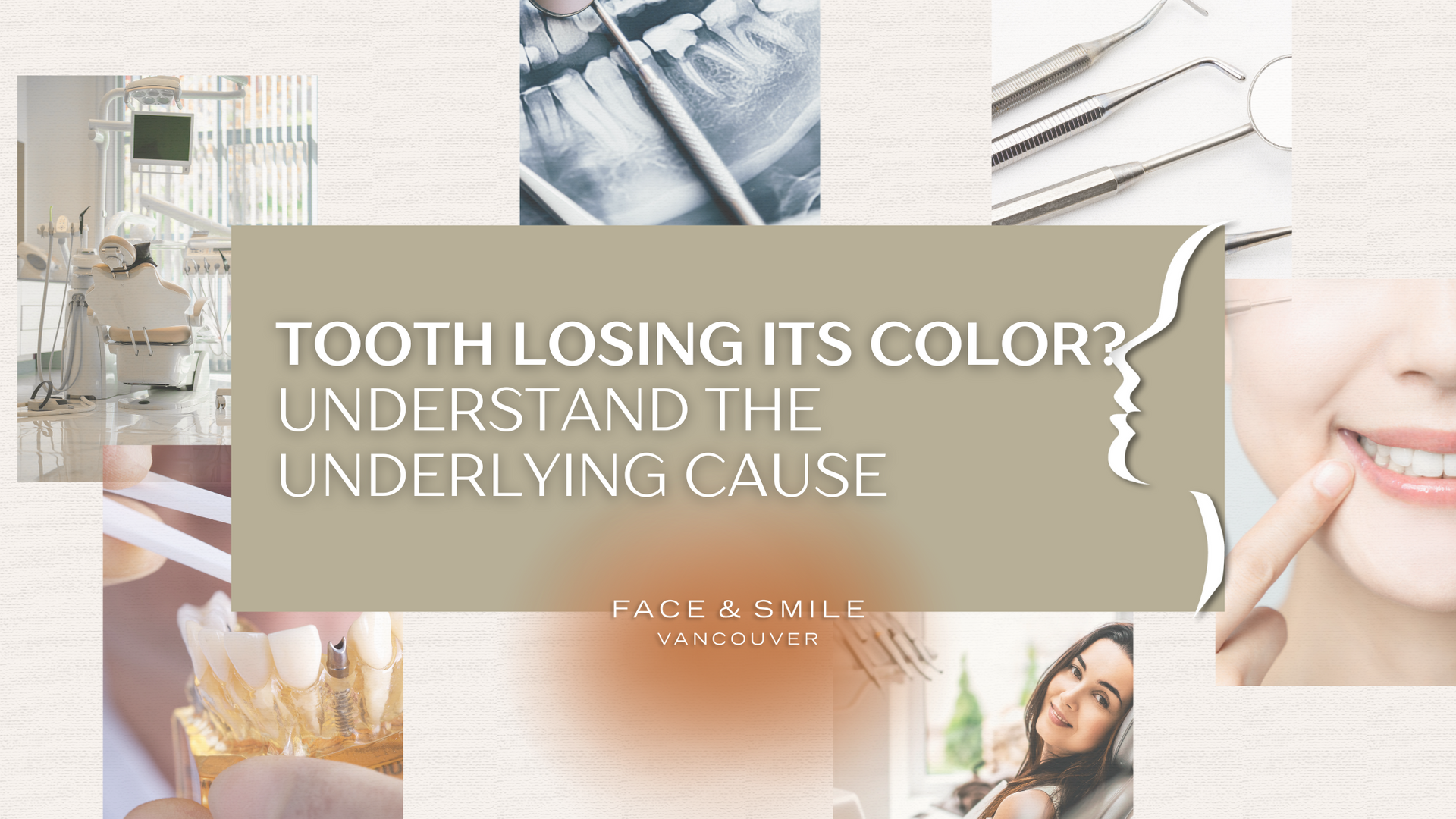 Tooth losing its color ? understand the underlying cause