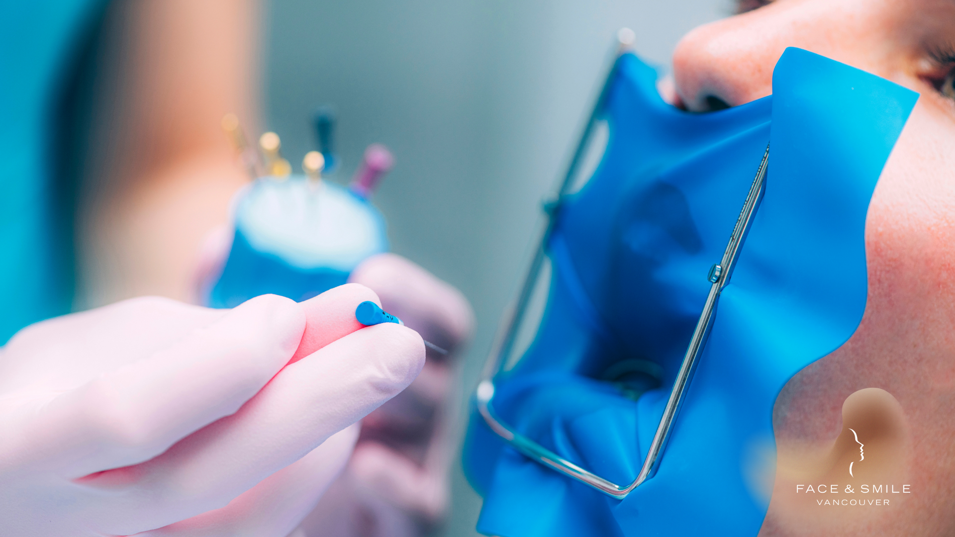 A dentist is applying a blue rubber dam to a patient 's mouth.