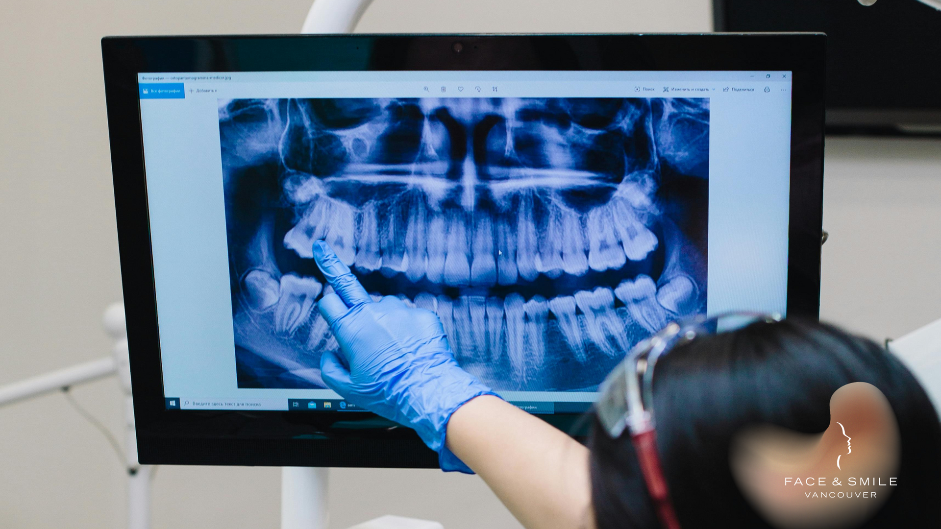 Dentist pointing at a panoramic dental X-ray displayed on a monitor