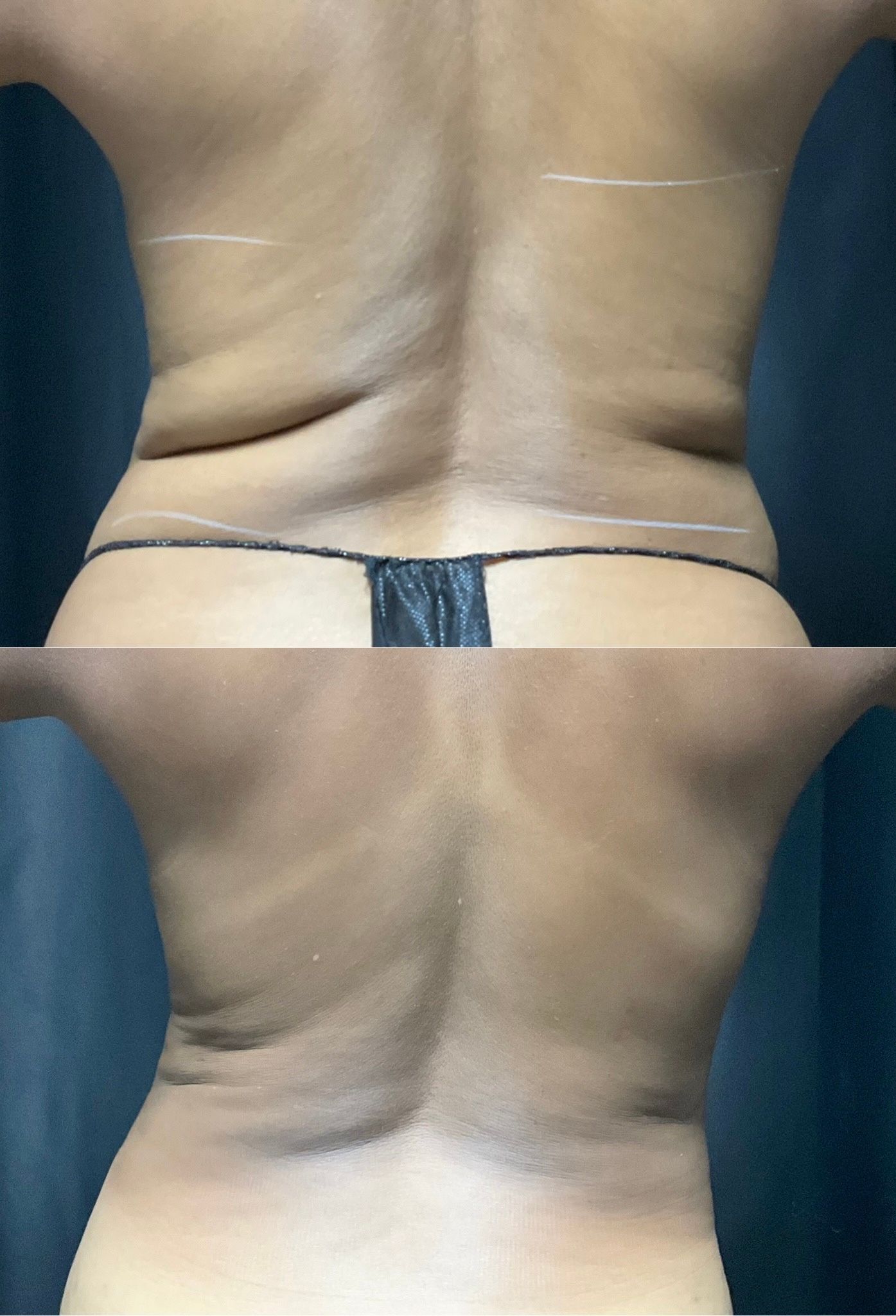 Back view of a person showing lower back and waist before and after lighting change