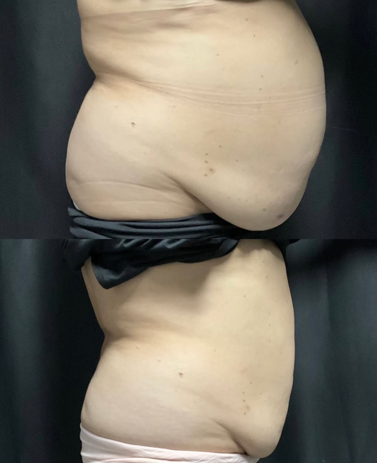 Side-view torso with a black band wrapped around the waist against a dark background.