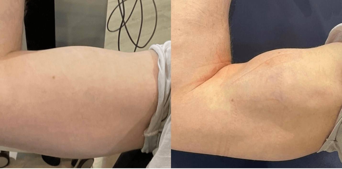 improved muscles