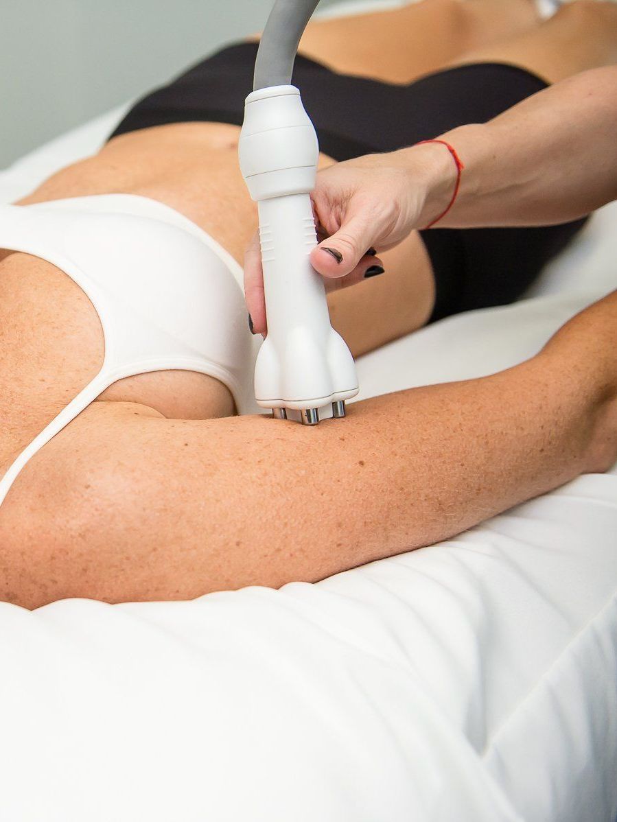 arm skin tightening