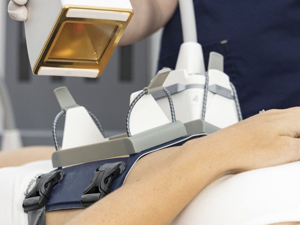 laser lipo treatment