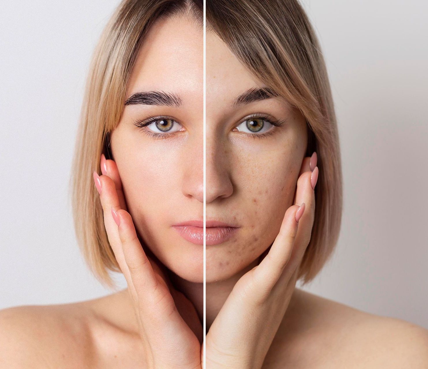 a before and after photo of a woman 's face