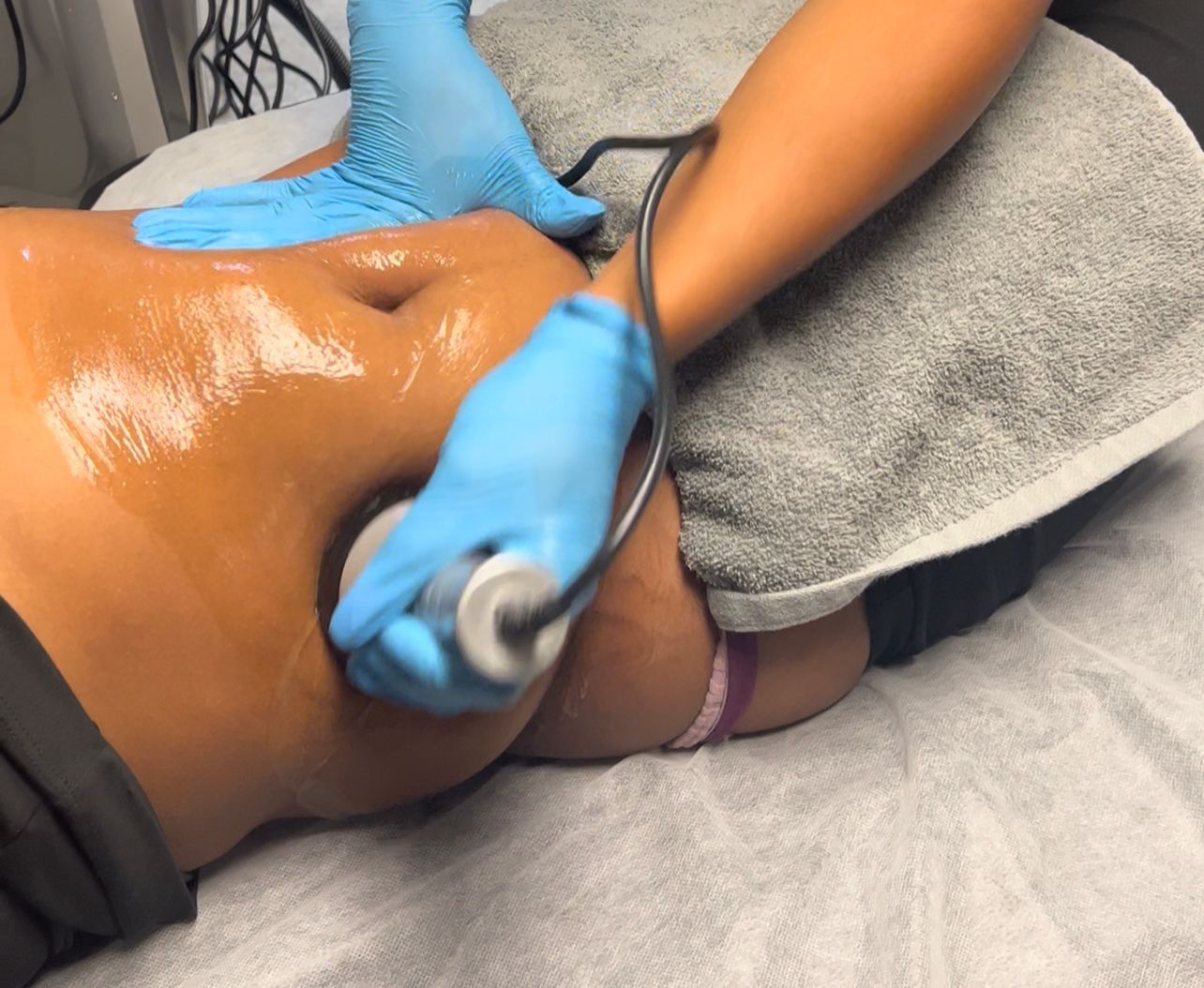 Gloved hands use a handheld device on a person’s oiled torso during a skin treatment.