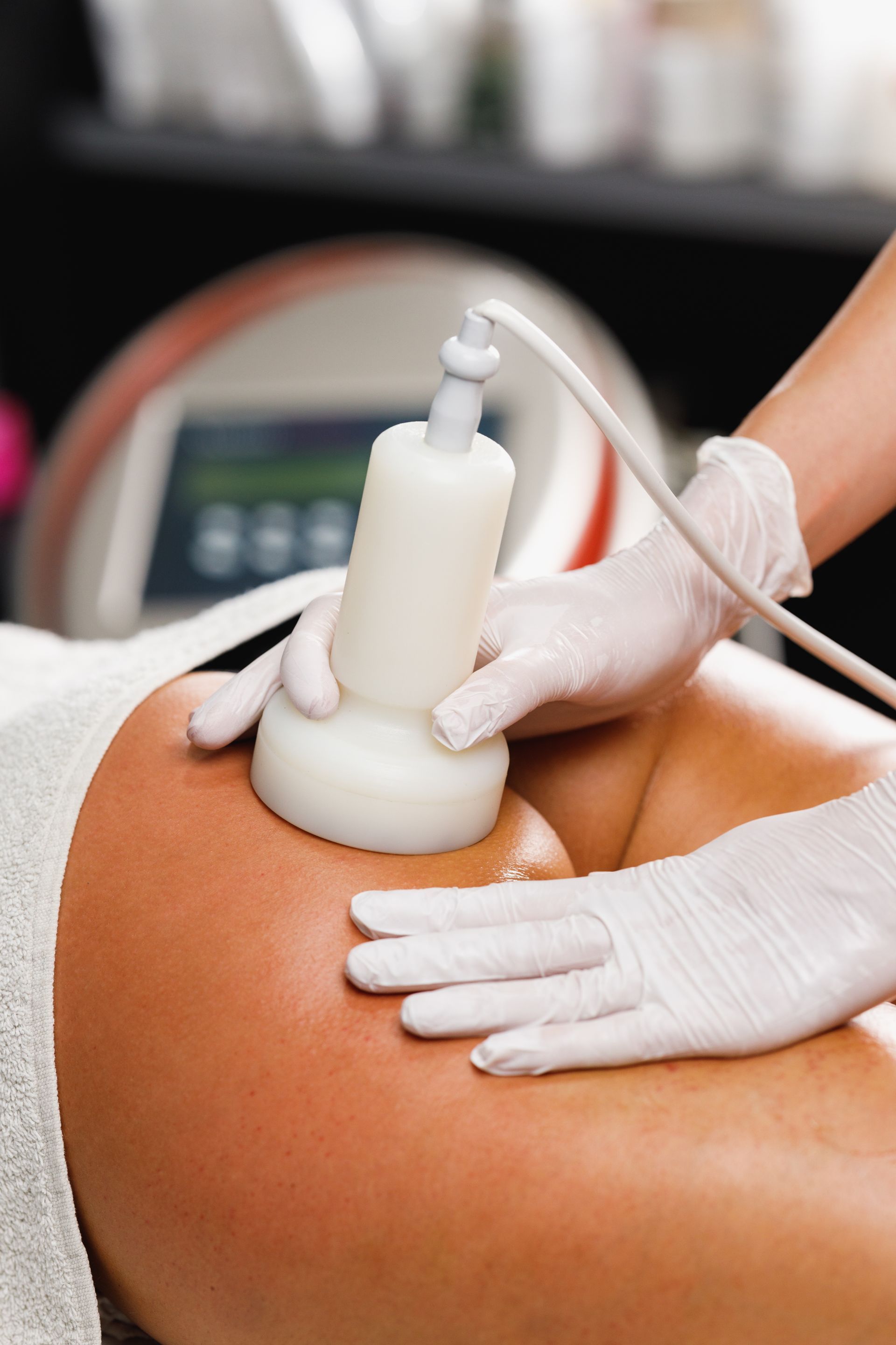 patient receiving cavitation treatment