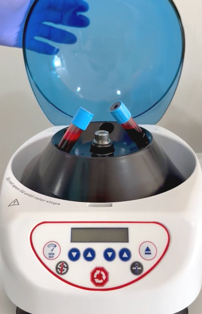 Laboratory centrifuge with a blue lid open and a gloved hand adjusting the sample tubes
