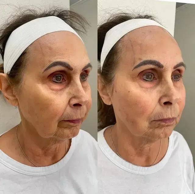 Side-by-side portrait of the same woman with a white headband, showing different facial expressions and eye appearance