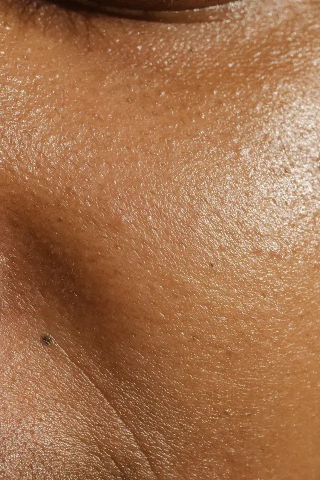 Close-up of a person's neck and shoulder with smooth, glistening skin and a small dark mole