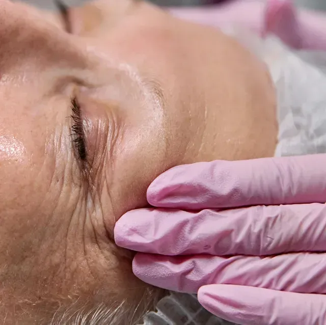 Gloved hand gently touches an older person’s face during a skincare treatment