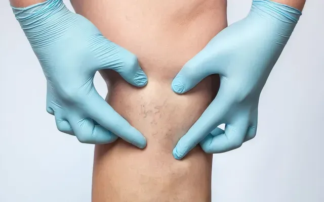 Gloved hands pressing and pinching a person’s abdomen skin for a medical examination
