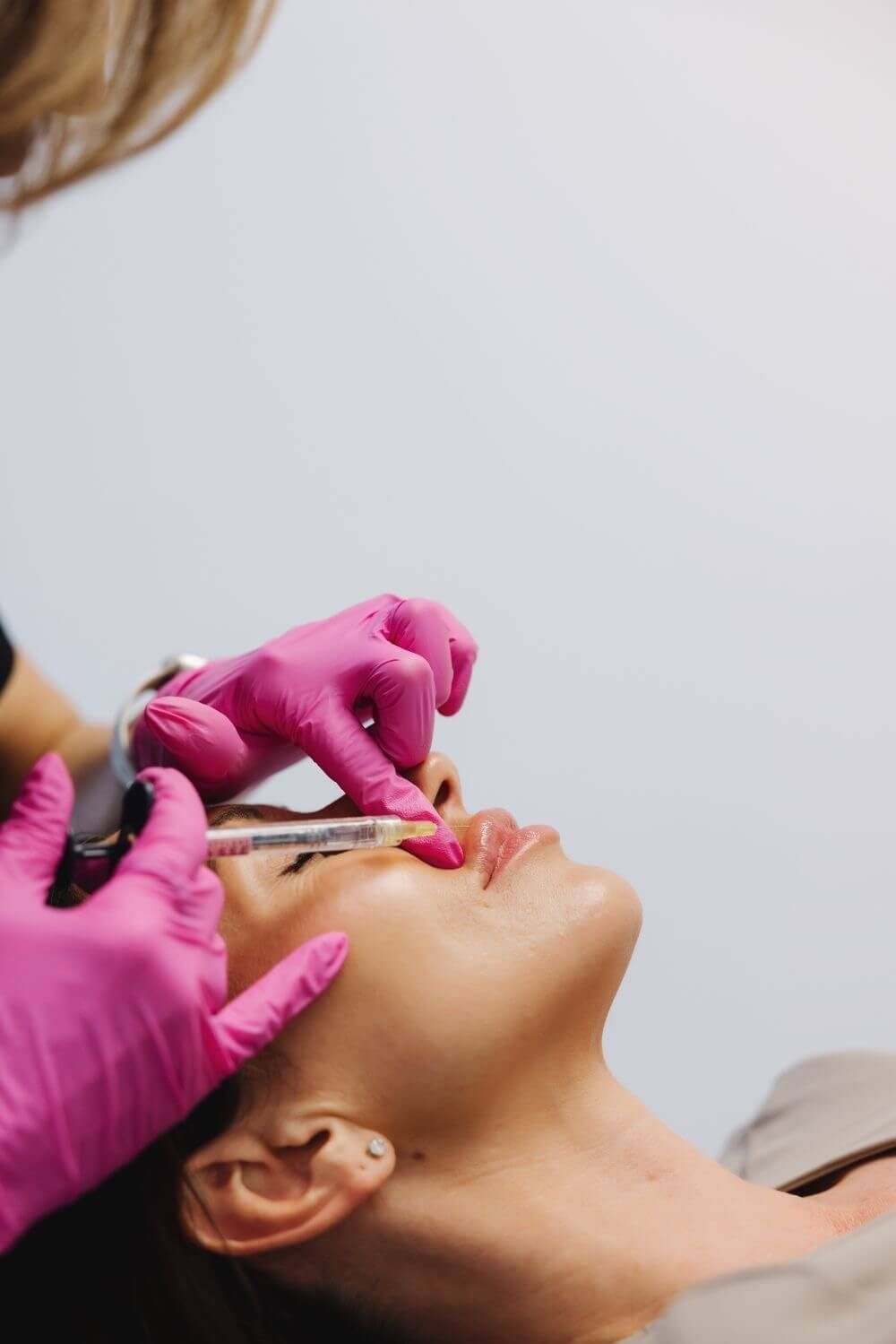 Best Lip Filler Bellevue