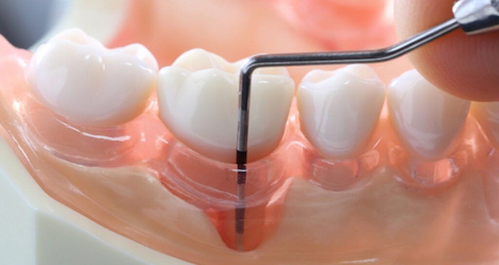 dentista con trapano e specchietto