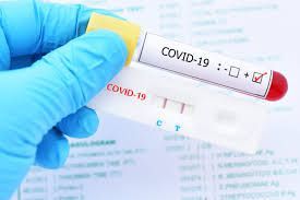 PRUEBA COVID (sangre)