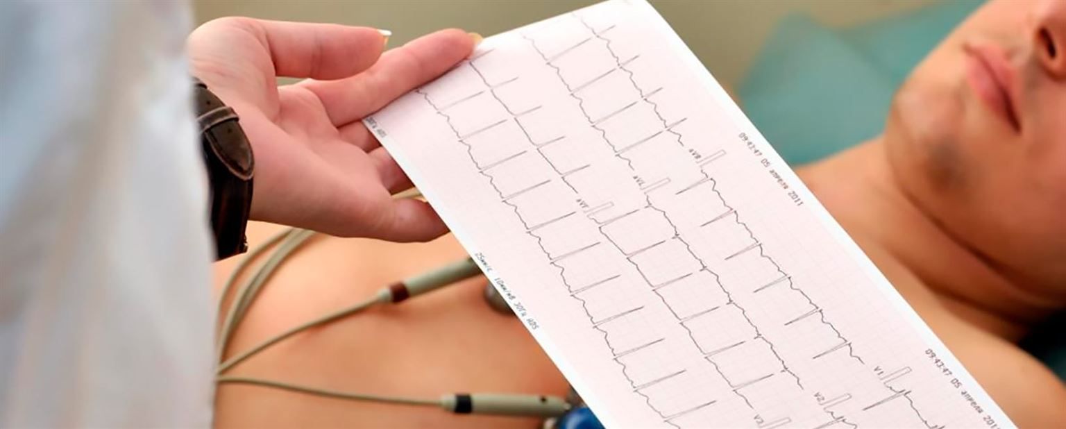 ELECTROCARDIOGRAMA