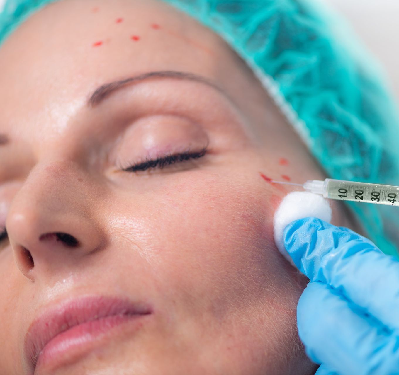 prp skin rejuvenation treatment