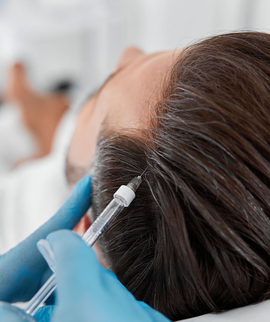 PRP hair rejuvenation treatment