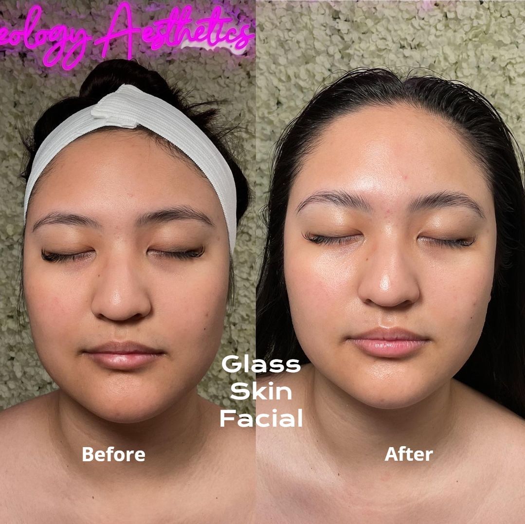A woman 's face before and after a glass skin facial