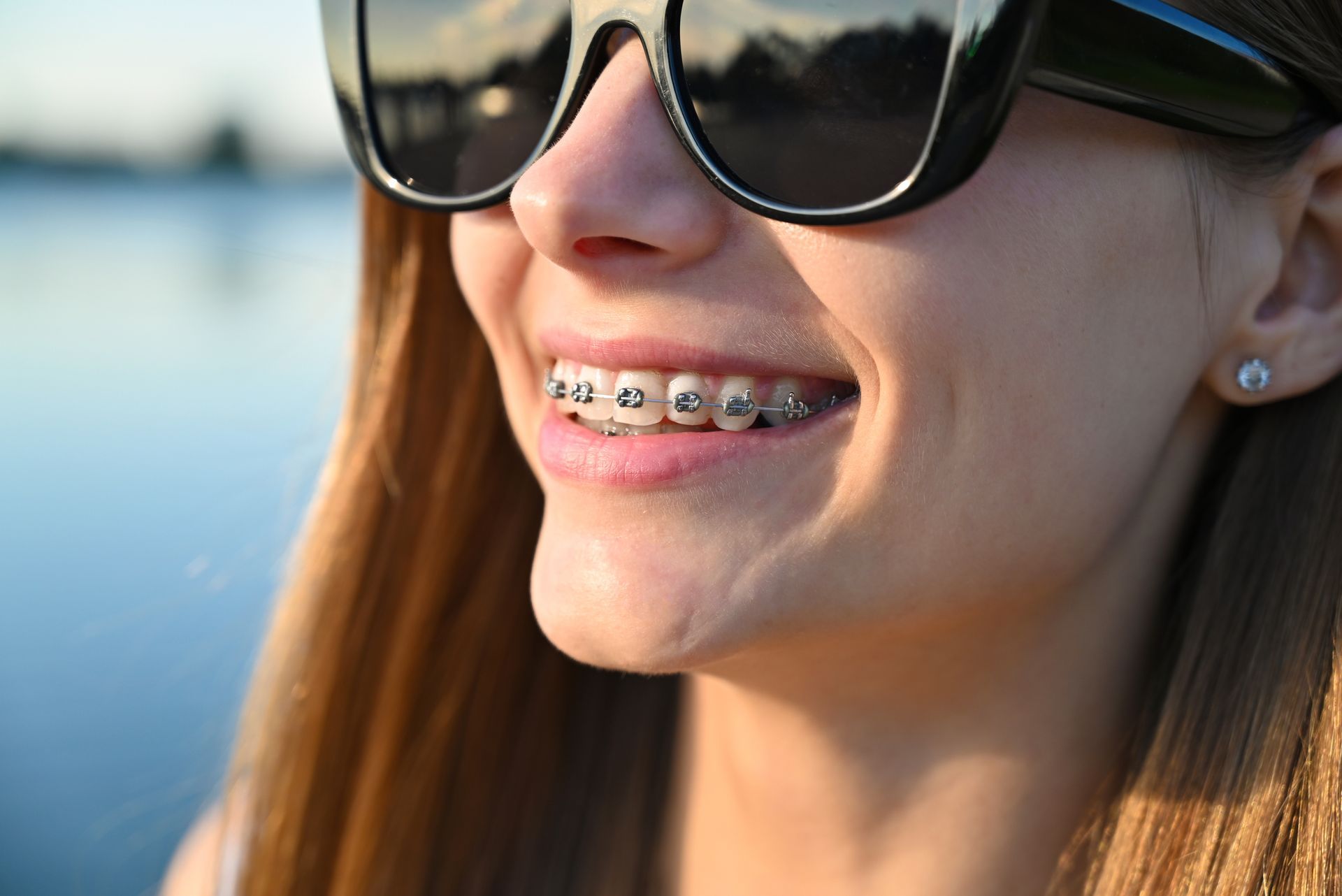 Orthodontics For Teens – Riverton, UT – Welton Orthodontics