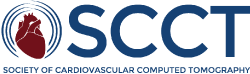 SCCT