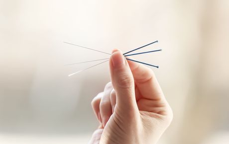 Acupuncture needles - traditional Chinese medicine treatment