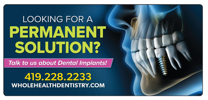 Dental Implants Poster — World Health Dentistry — Lima, OH Dental Implants Poster — World Health Dentistry — Lima, OH