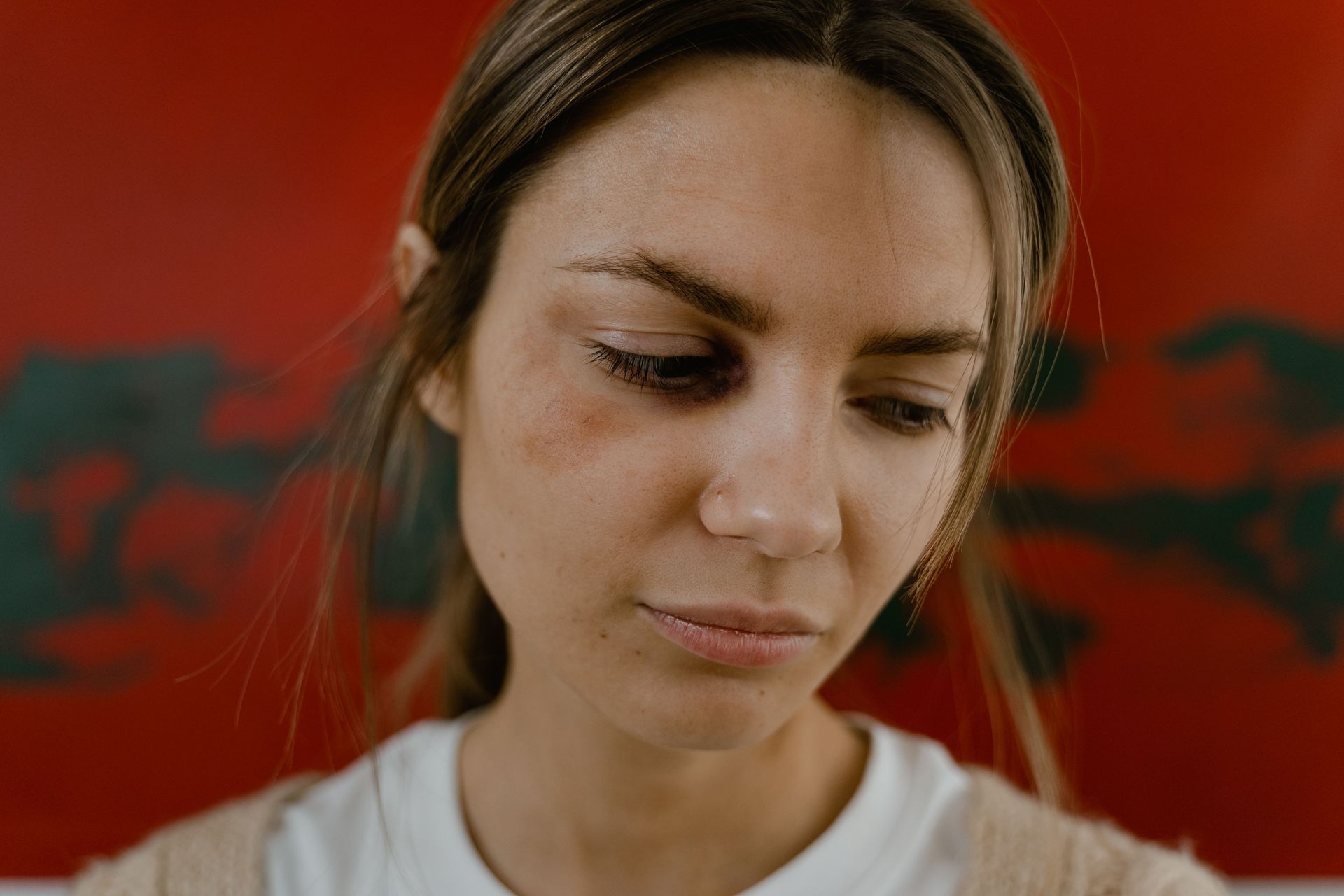 Woman with a black eye looking down against a red background, wearing a white shirt and beige cardigan.