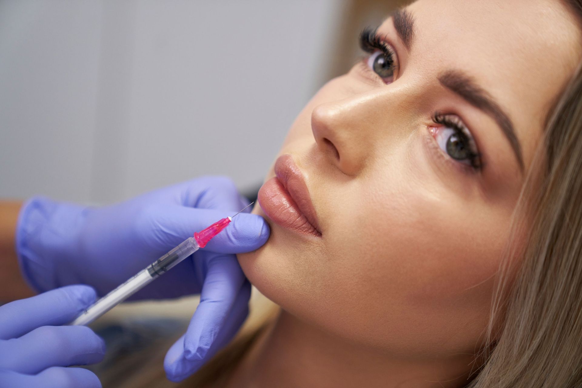 Gloved hands inject filler into a woman’s lips with a syringe in a cosmetic procedure.