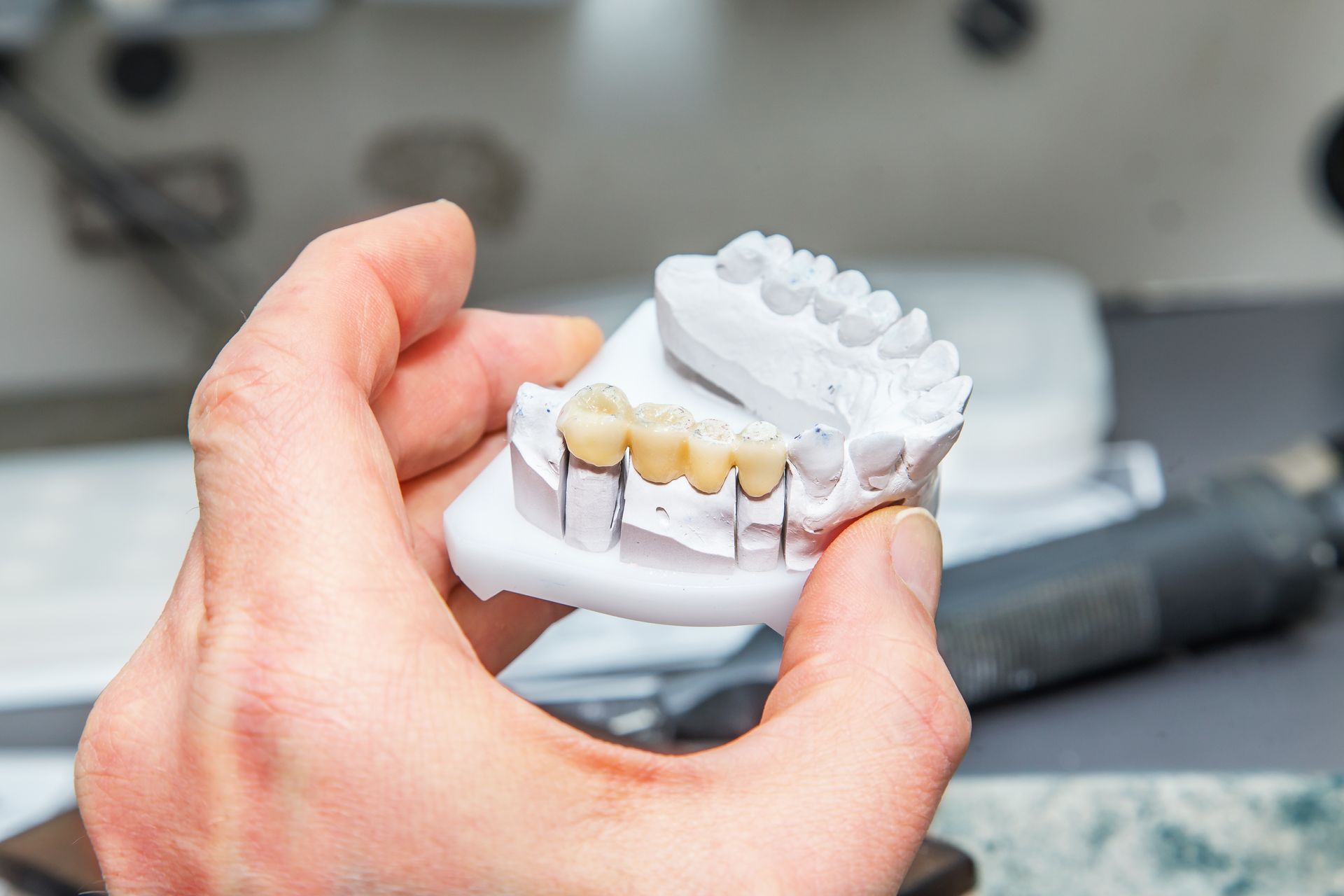 Hand holding a dental model with teeth and braces in a clinic setting