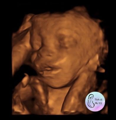 Pregnant woman smiling, holding ultrasound picture of her baby.