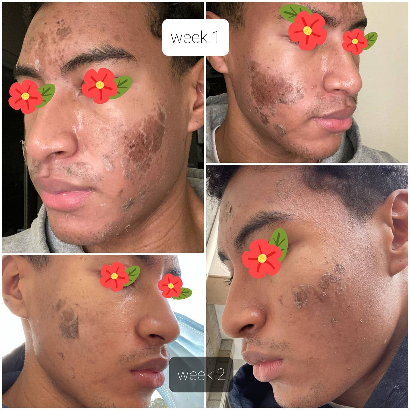 A man 's face is shown from week 1 to week 2