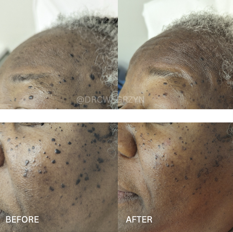 A before and after photo of a woman 's face