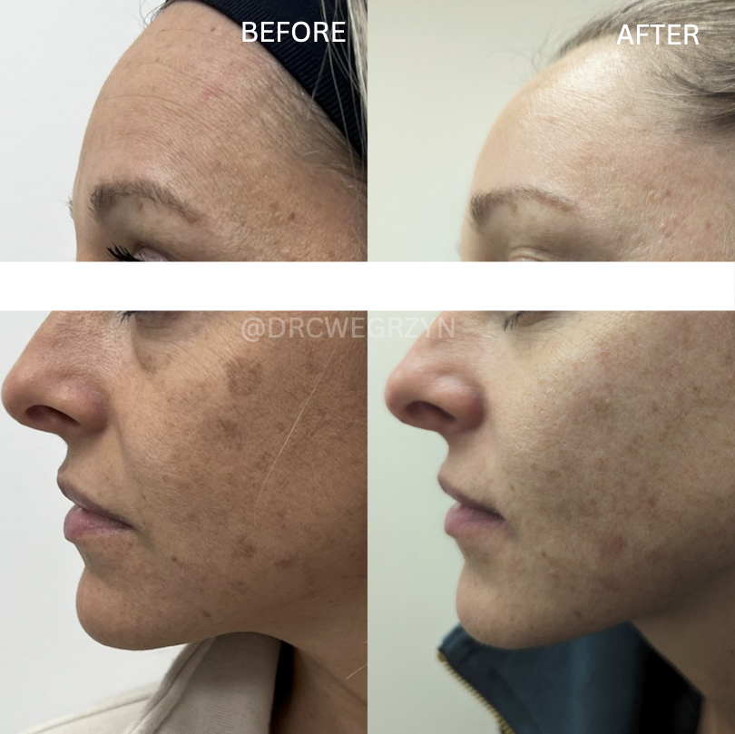 A before and after photo of a woman 's face