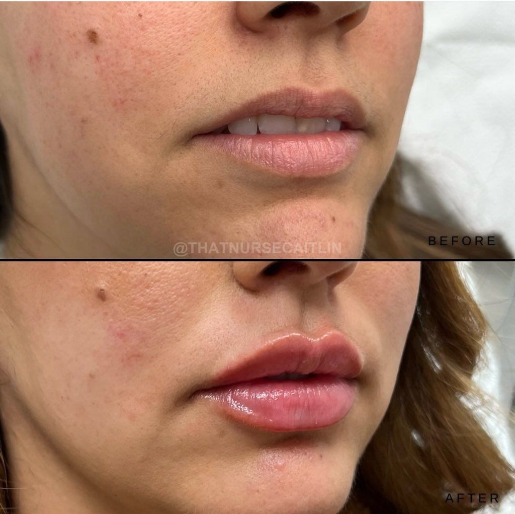 A before and after photo of a woman 's face