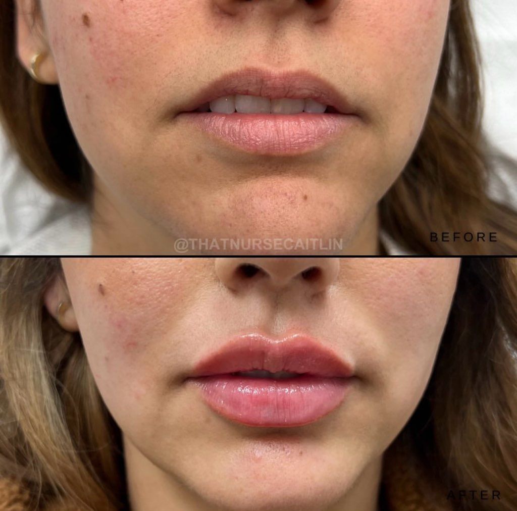 A before and after photo of a woman 's face