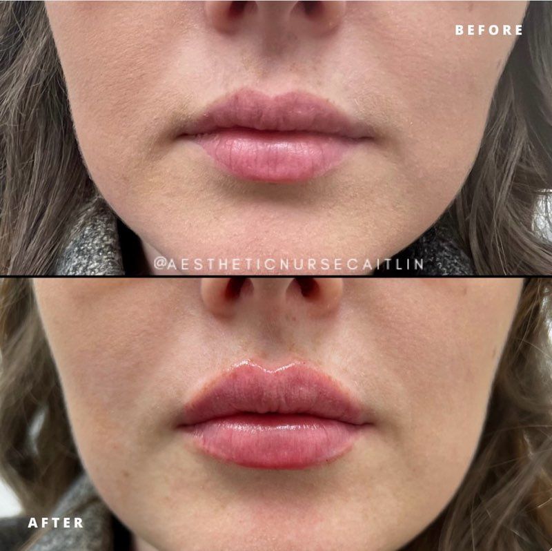 A before and after photo of a woman 's face