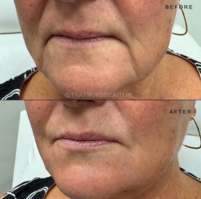 A before and after photo of a woman 's face