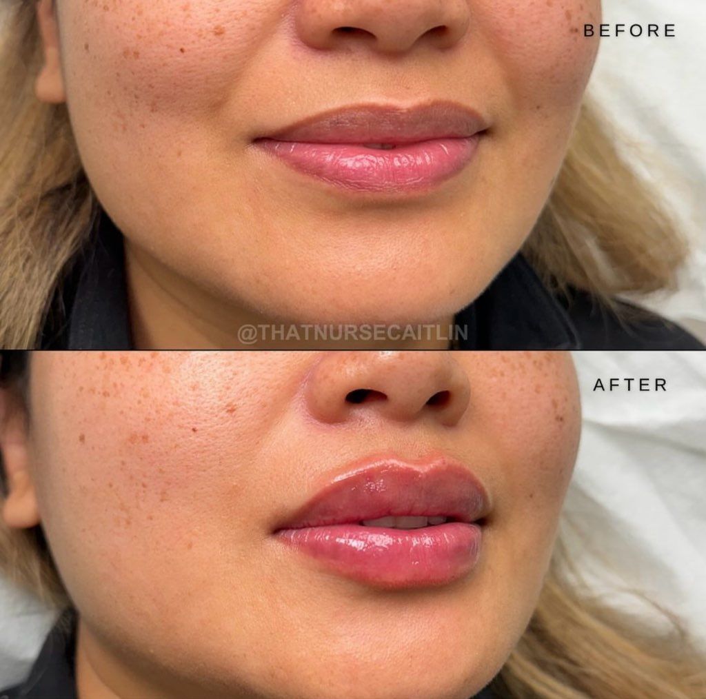 A before and after photo of a woman 's face