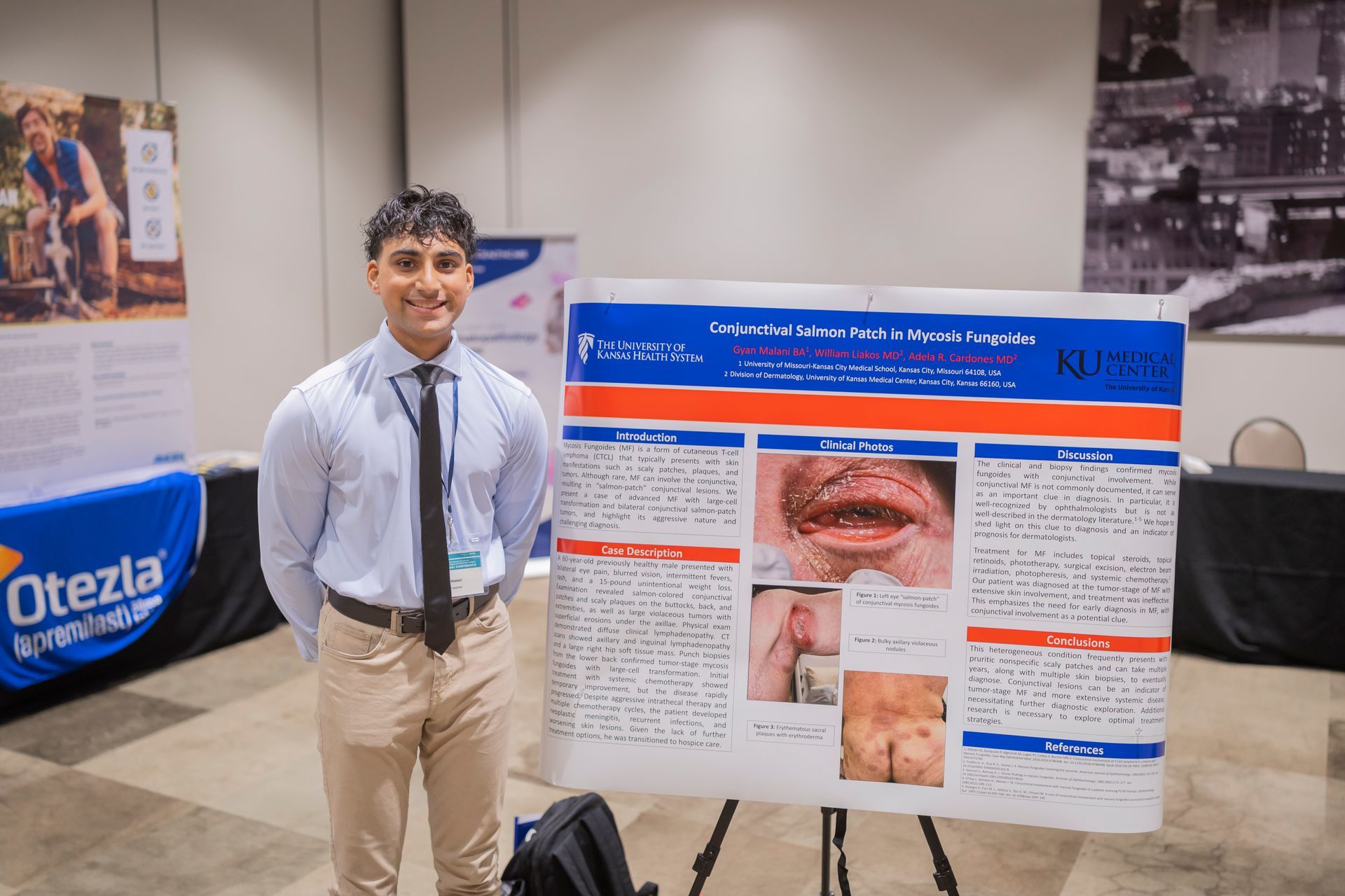 Person stands beside a medical research poster at a conference booth, with an Otezla banner in the background.