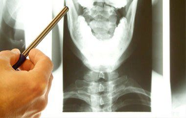 Spine X-Ray — Portage, MI — Cornerstone Chiropractic Center