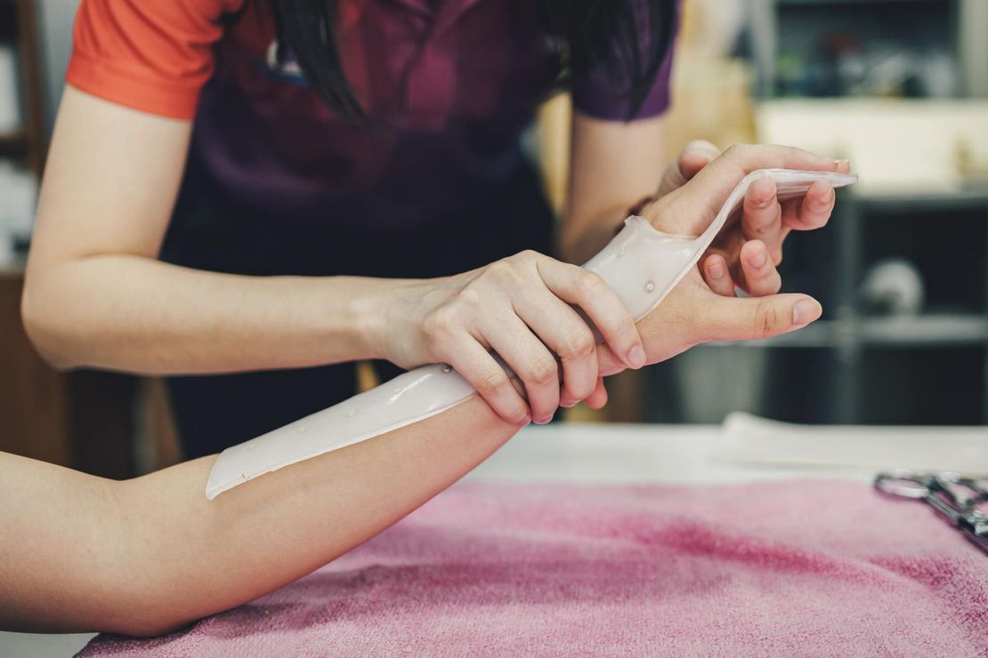 Splint-service-for-hand-injury-rehabilitation-of-occupational-therapy-clinic