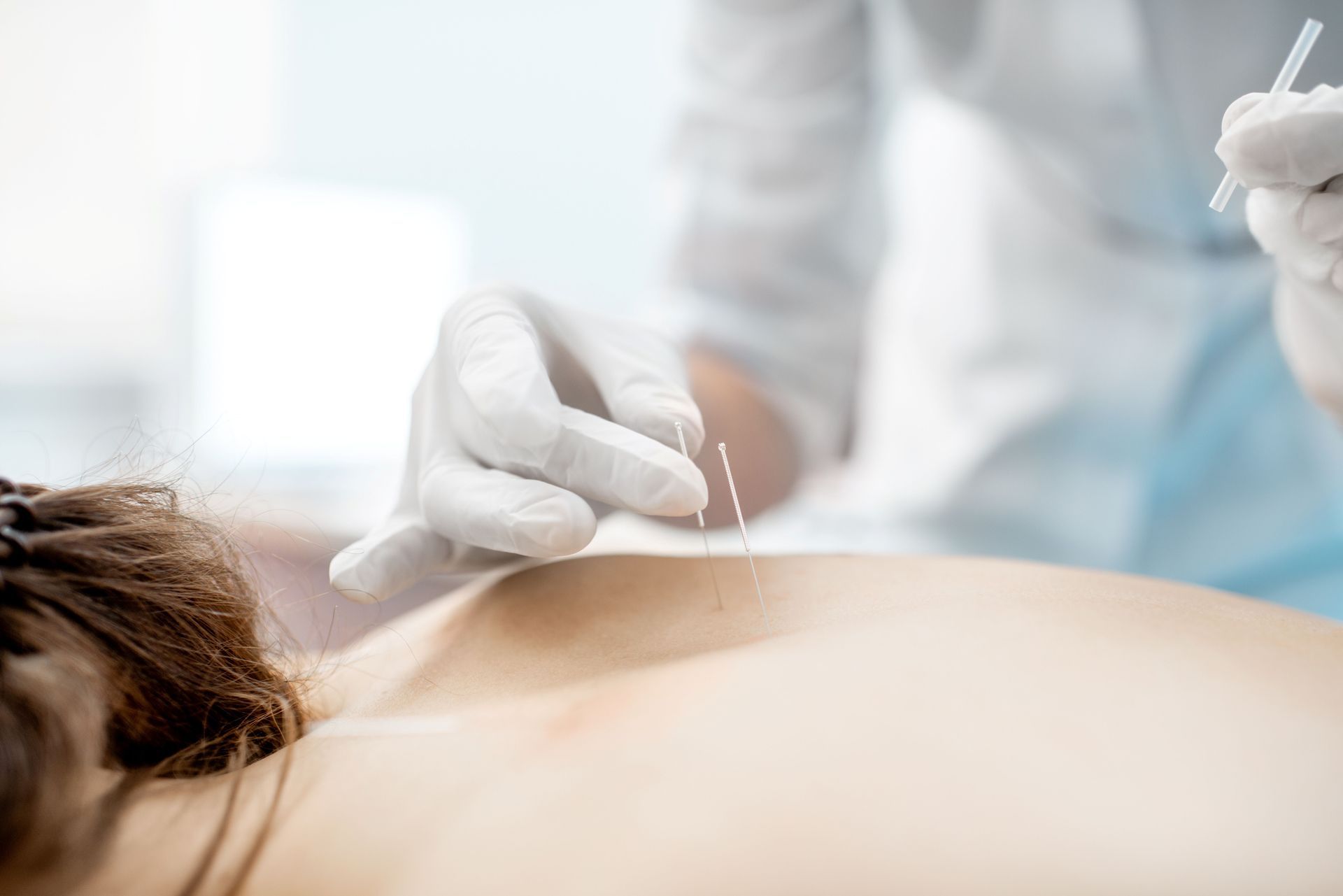 Benefits of Visiting a Professional Acupuncture Clinic