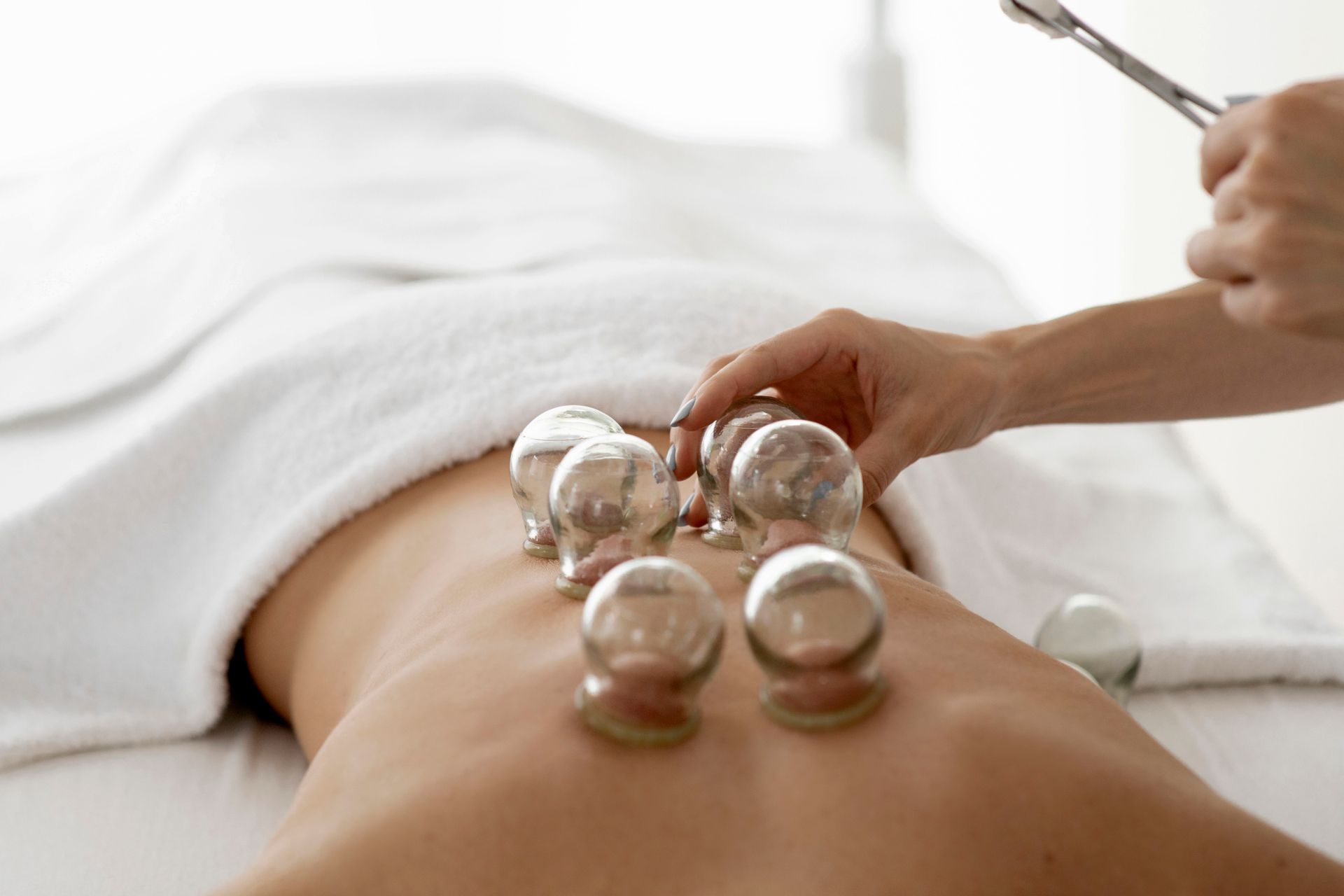 Cupping Solutions